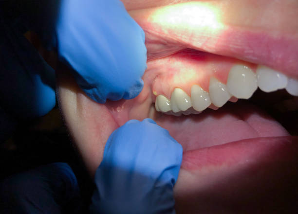 Best Emergency Tooth Extraction  in Cumberland, WI